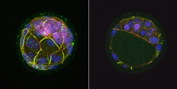 Mouse blastocyst displaying expression of Nanog genes
